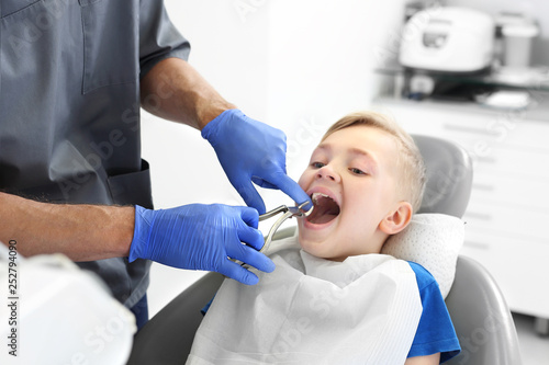 Ekstrakcja, wyrywanie zęba, gabinet stomatologiczny. Dziecko u dentysty