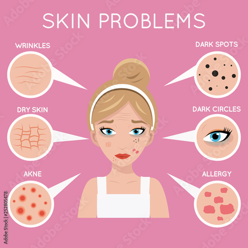 Skin problems face women cosmetic care problem beauty cosmetics medicine beautiful girl head design vector illustration