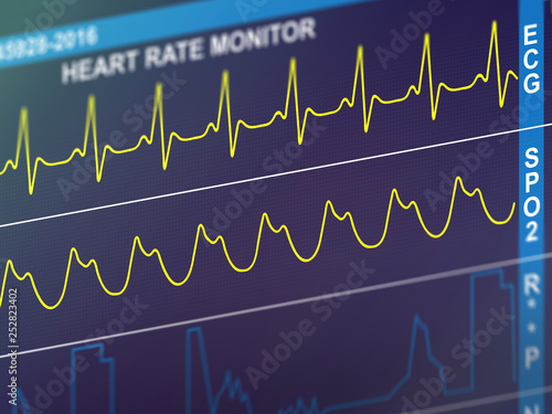 EKG cardiac frequency