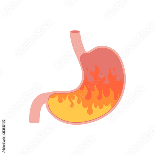 Human stomach with fire
