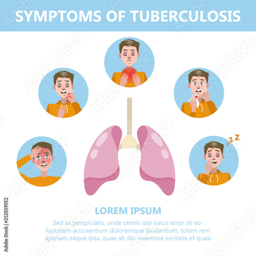 Tuberculosis symptoms and signs. Cough and chest