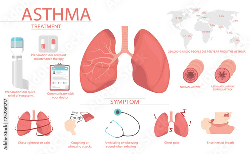 Detail about of asthma symptoms and causes have man. Medical education chart of biology for lungs diagram. Vector illustration in flat style for medical atlases, articles, infographics. photo