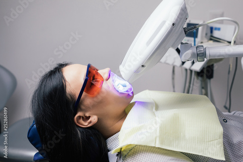 Laser bleaching teeth at dantist room. Teeth whitening for woman. Bleaching of the teeth at dentist clinic. photo