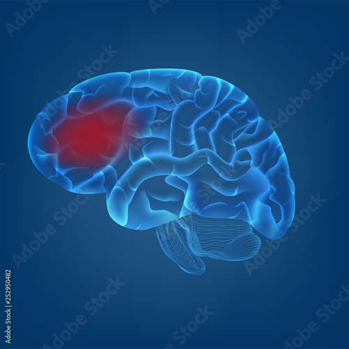 isolate of 3D of human brain with migraine headache image in digital blue background. concept for MRI scan for medical healthcare or human body scientific in vector illustration