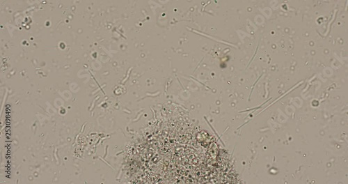 Bacteria type in wastewater under the microscope in laboratory. photo