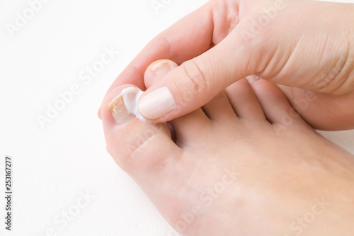 Young woman s hand using and applying moisturizing cream on foot nail. Dry  damaged toe nails. Woman s issues. Problem and solution. White background. Close up. Top view. 