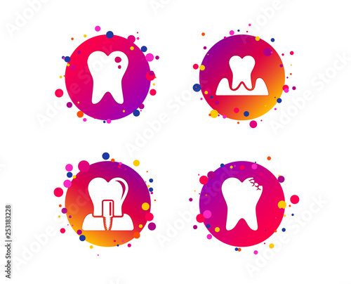 Dental care icons. Caries tooth sign. Tooth endosseous implant symbol. Parodontosis gingivitis sign. Gradient circle buttons with icons. Random dots design. Vector
