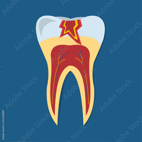 teeth caries concept vector symbol illustration