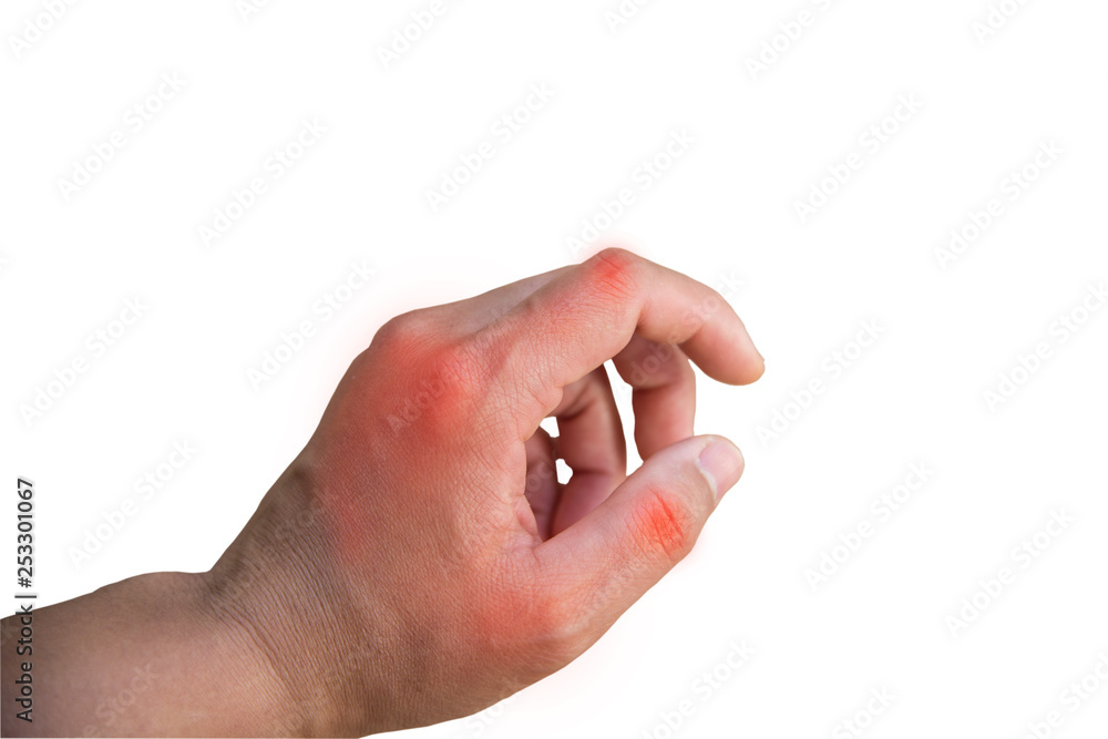 Close up hand arthritis on white background.