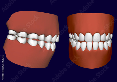 Human jaw with teeth. Side and front view. 3D. Isolated jaw on a white background. Healthy human teeth. Prosthetic teeth. Vector illustration