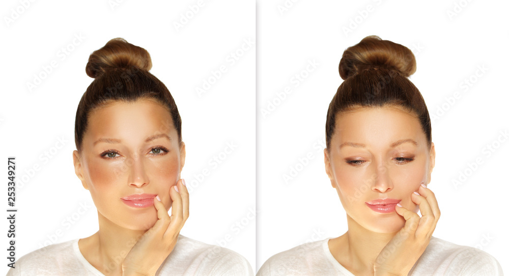 Dark spots, freckles,hyperpigmentation(melasma or chloasma)