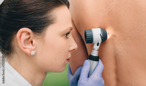 dermatoscopy. female doctor inspecting patient skin moles
