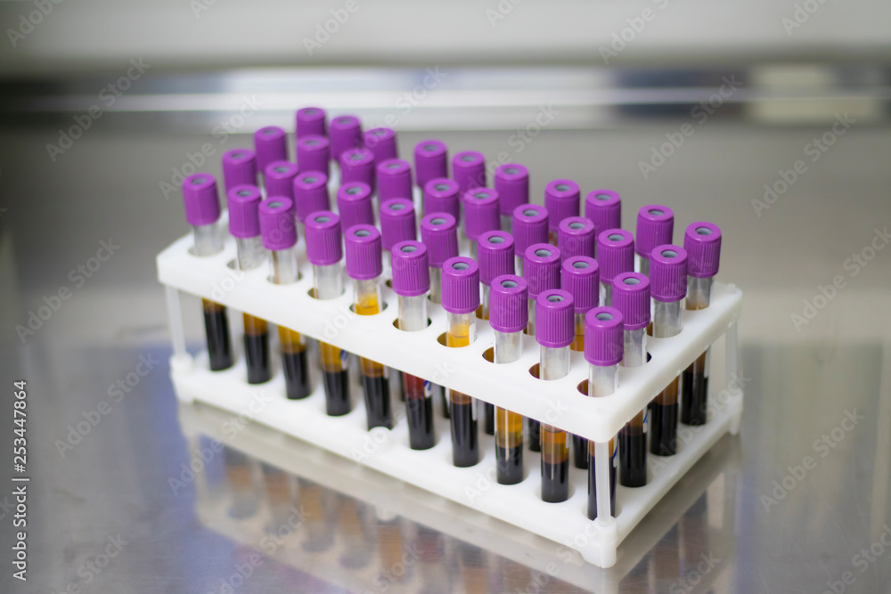 A tripod full of blood tubes. Concept: medicine, blood test A tripod full of blood tubes. Concept: medicine, blood test
