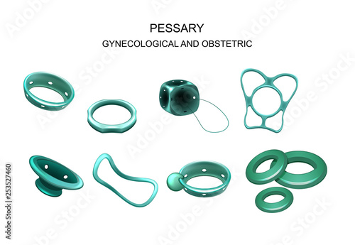 gynecological and obstetric pessary photo