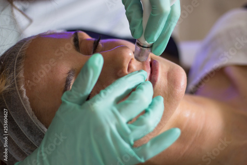 Closeup view of female face getting facial cleansing or dermabrasion treatment. photo
