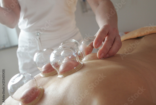 Schröpfmassage