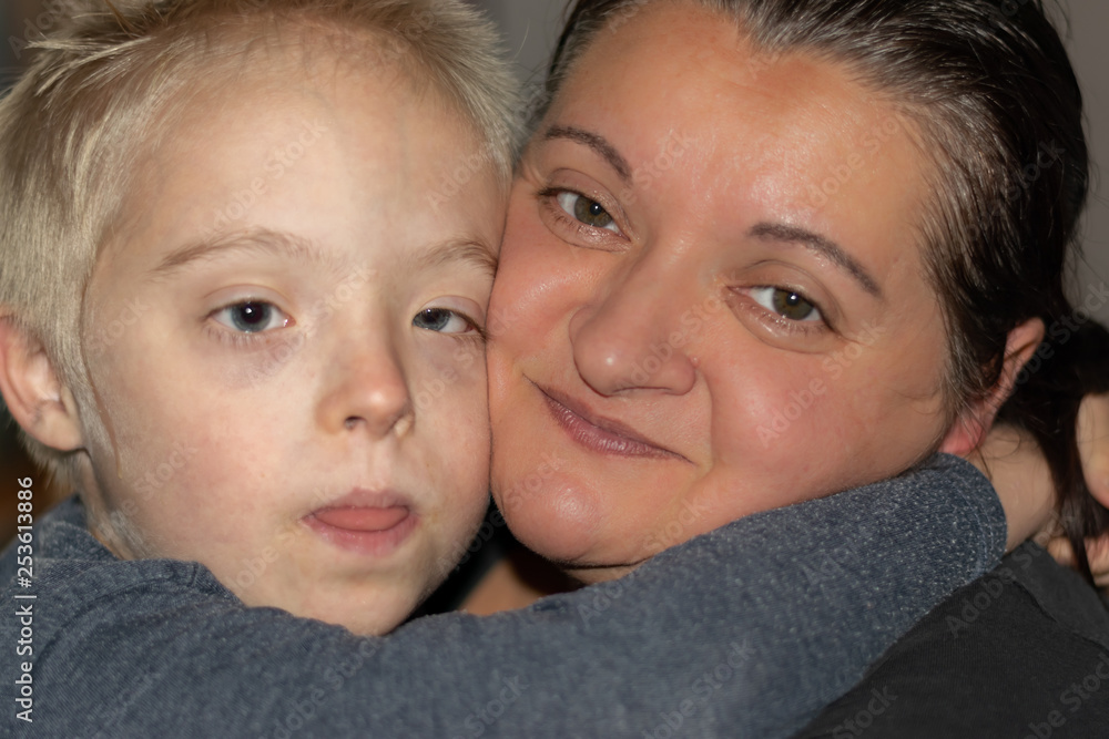 Defect,childcare,medicine and people concept- happy mother and son with down syndrome together at home. Defect,childcare,medicine and people concept- happy mother and son with down syndrome together at home.