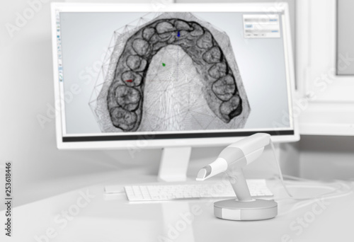 Dental 3d scanner and monitor in the dentist's office photo