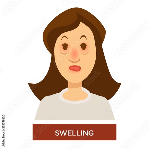 Swelling allergy or angioedema symptom bags under eyes and inflammation