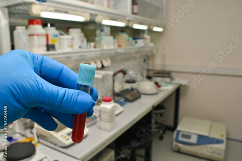 Laboratory examination of a blood sample.