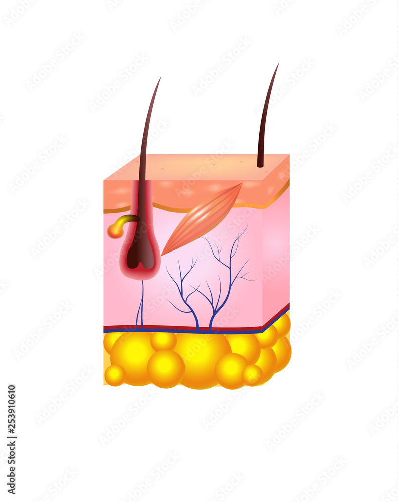 Laser hair removal image infographic design. Aesthetic medicine poster.