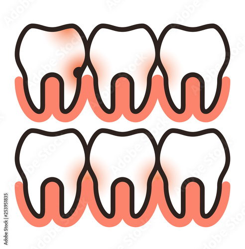 Toothache and paradontosis