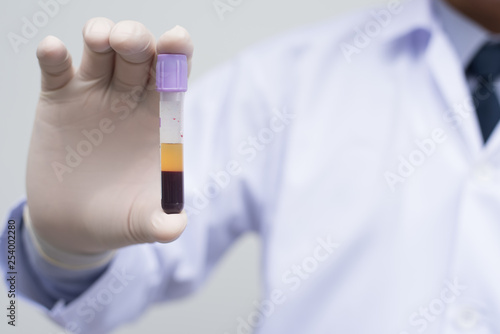 Male doctor showing  centrifuge blood test tube
