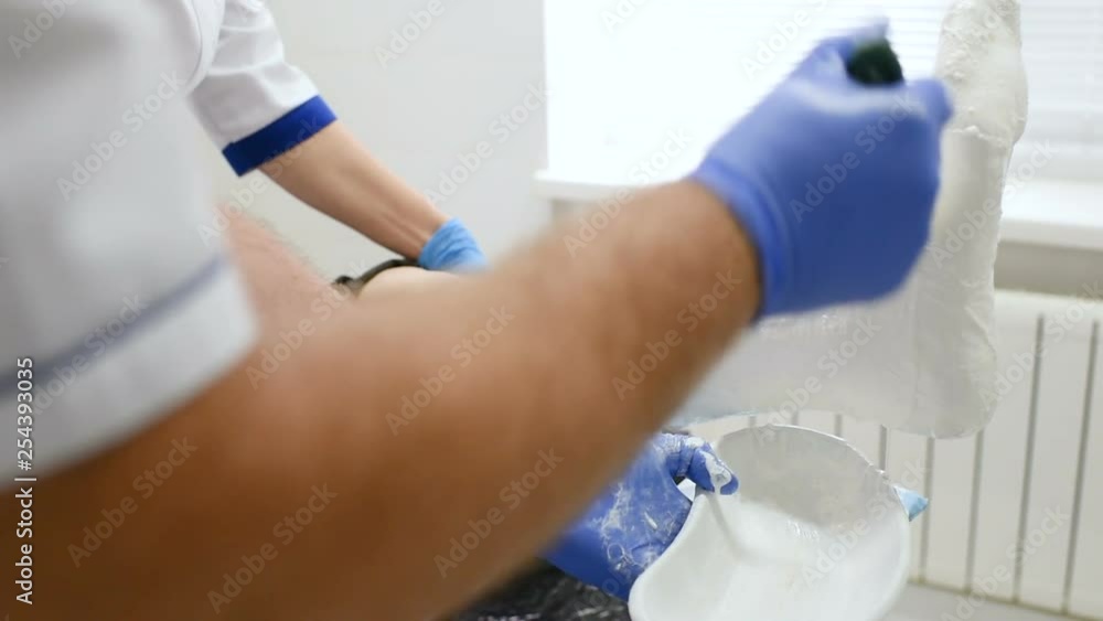 doctor traumatologist puts a plaster or cast on the broken leg of the patient. doctor traumatologist puts a plaster or cast on the broken leg of the patient.