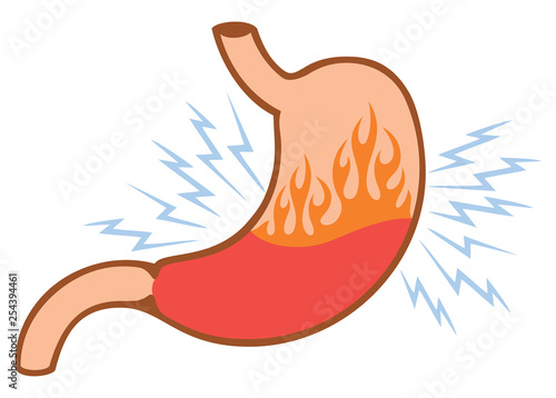 human internal stomach heartburn problems concept