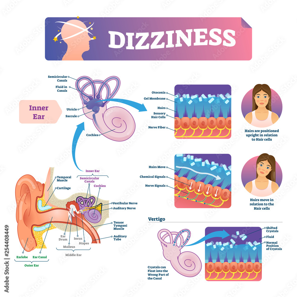 Dizziness vector illustration. Labeled scheme with inner ear and