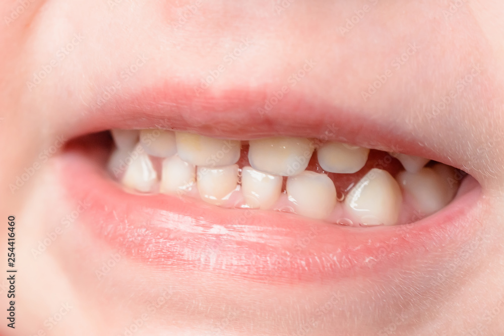 Fototapeta premium Little baby's teeth are shot at the macro when she laughs