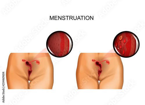 female reproductive organs. menstruation photo
