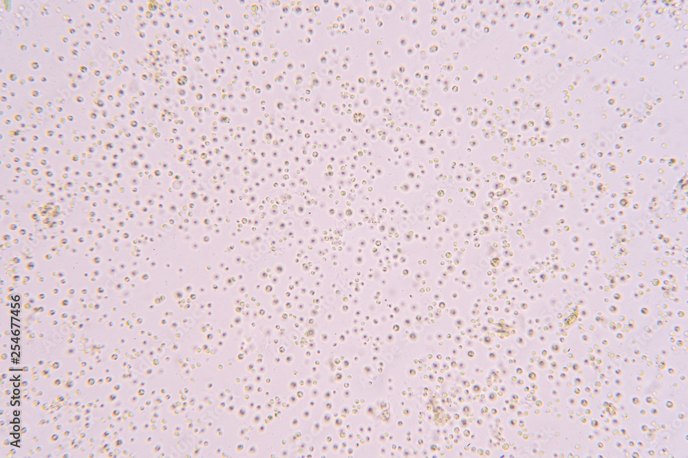 Chlorella is a genus of single-celled green. Chlorella is a genus of single-celled green.