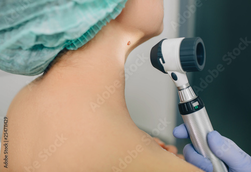 dermatologist exam skin mole on female neck using dermatoscope
