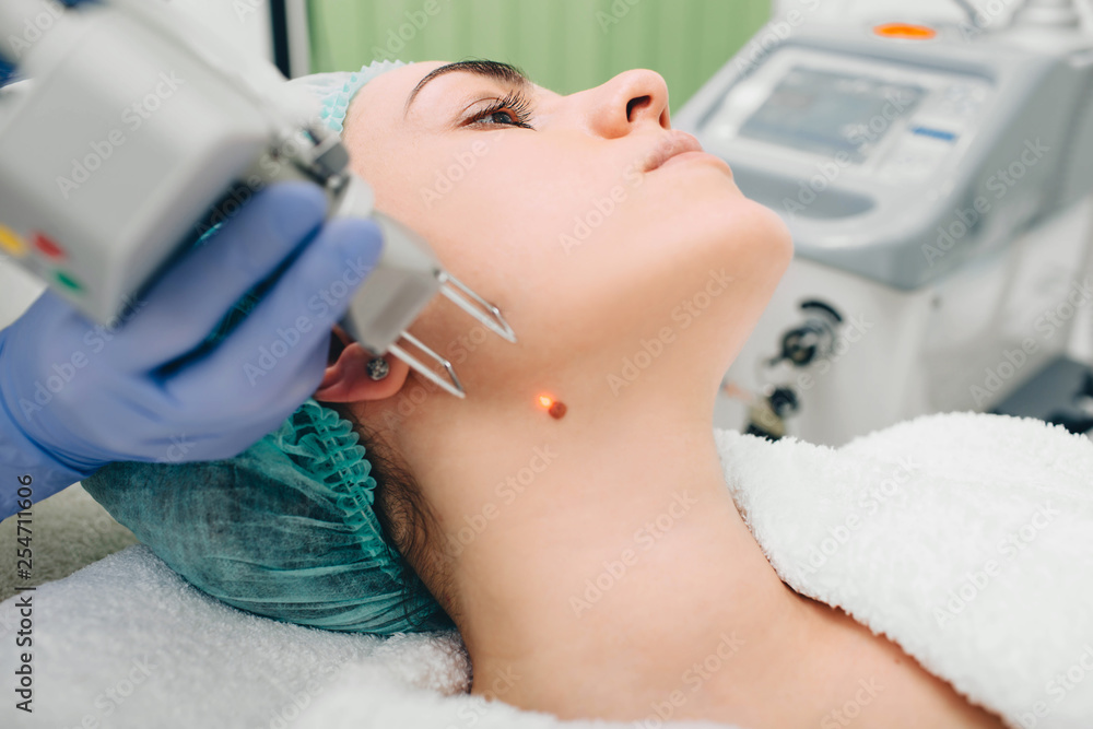 Patient getting laser mole removal. skin moles treatment. Patient getting laser mole removal. skin moles treatment.