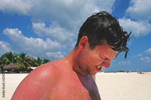 Young attractive man winces in pain from sunburn during tanning