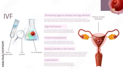 In Vitro Fertilization Stages. Medical Banner.