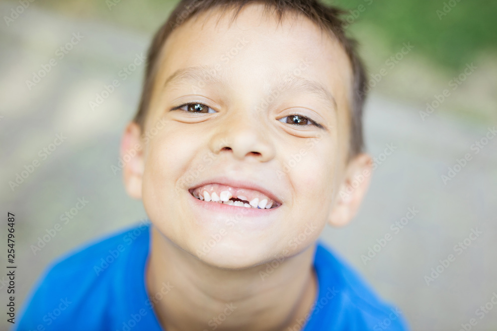 Young boy smiling and showing his changing baby teeth Young boy smiling and showing his changing baby teeth