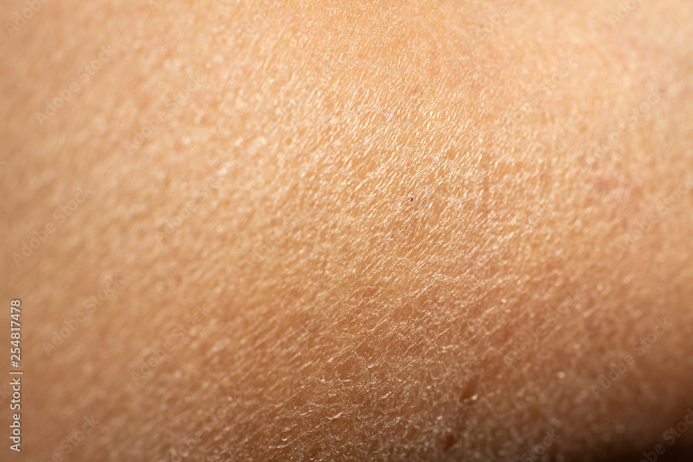 Woman's dry skin on leg, Close up & Macro shot, Asian skin tone, Abstract background Woman's dry skin on leg, Close up & Macro shot, Asian skin tone, Abstract background