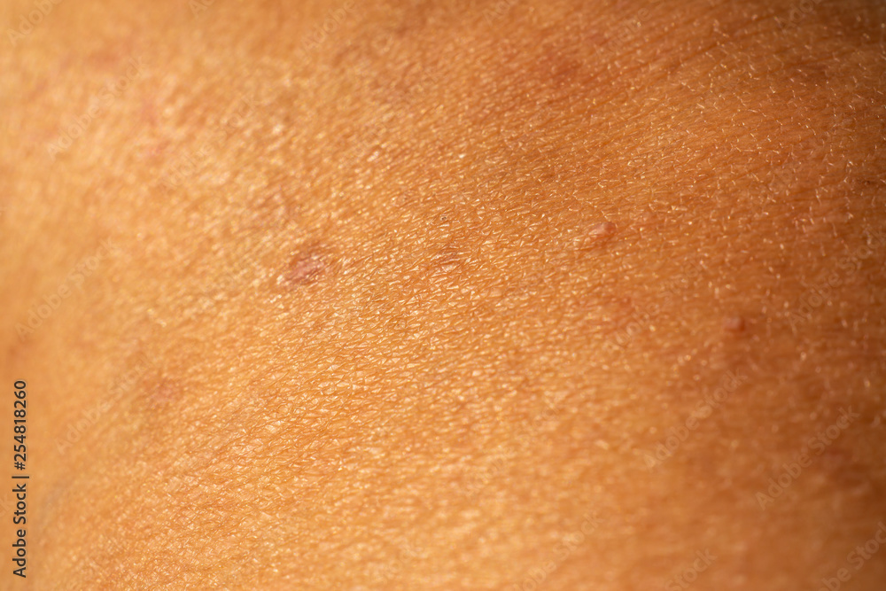 Fototapeta premium Woman's scar skin on leg, Close up & Macro shot, Asian Body skin part, Healthcare concept, Abstract background
