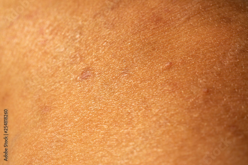 Woman's scar skin on leg, Close up & Macro shot, Asian Body skin part, Healthcare concept, Abstract background