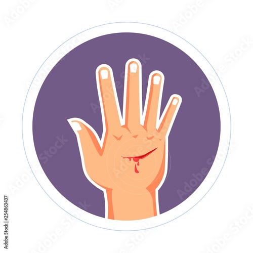 Injury cut on hand bleeding scratch skin damage