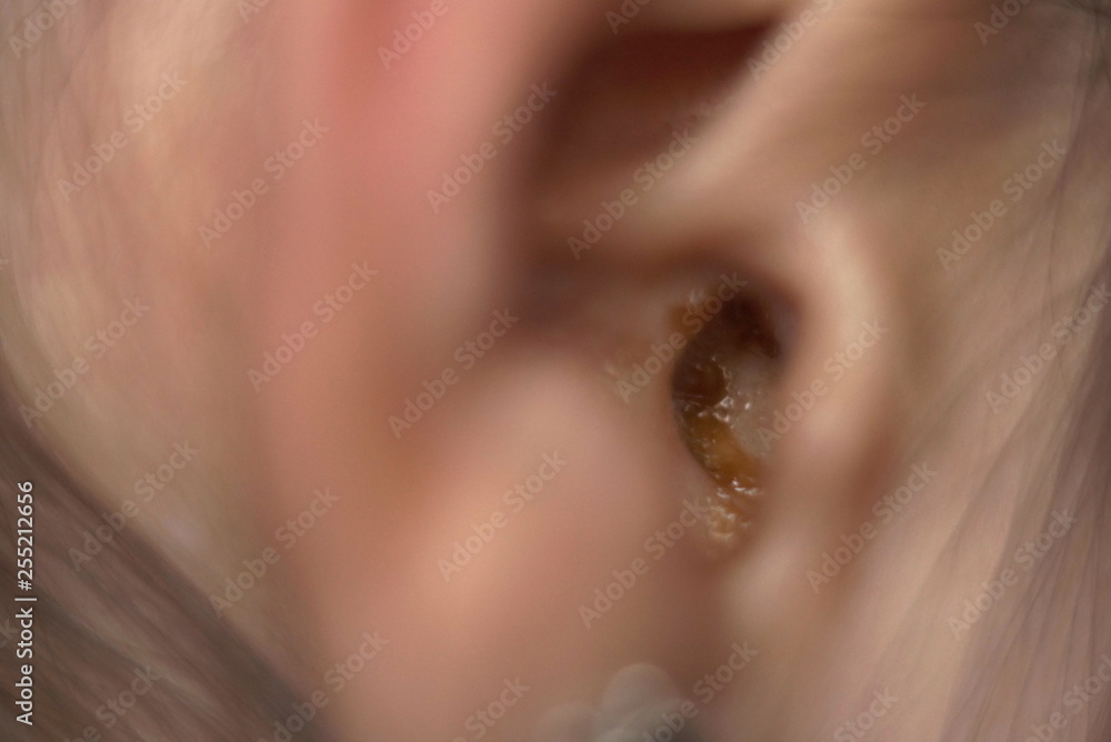 dirty human ear close up focus dirty human ear close up focus