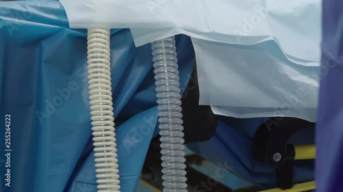 Tubes or transfusion equipment spill below blue medical sheets in hospital