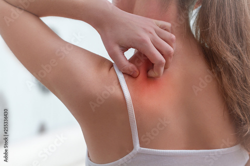 Canvastavla Young woman suffering from itching on her skin and scratching an itchy place