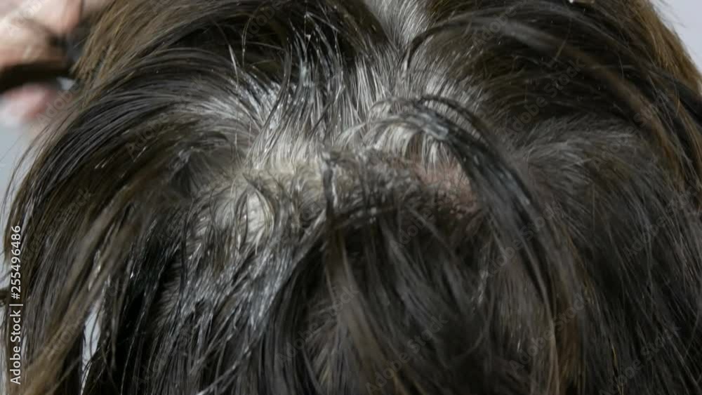 The overgrown gray roots of a middle-aged woman who colouring her hair herself with special brush. Dark hair and white roots of a woman's head on a white background. Hair care in salon close up view The overgrown gray roots of a middle-aged woman who colouring her hair herself with special brush. Dark hair and white roots of a woman's head on a white background. Hair care in salon close up view