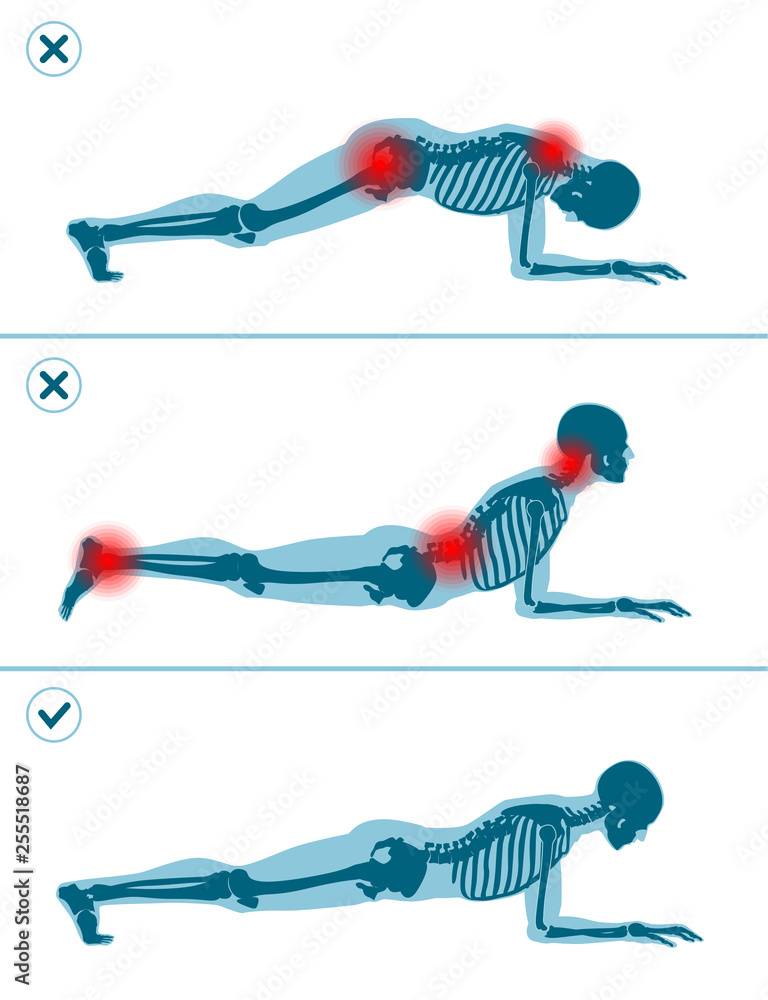 Wrong and correct plank position. Right and wrong execution technique of  sport exercise. Common mistakes in sport workout. Man standing on elbows.  Stock Vector | Adobe Stock