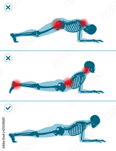 Wrong and correct plank position. Right and wrong execution technique of sport exercise. Common mistakes in sport workout. Man standing on elbows.