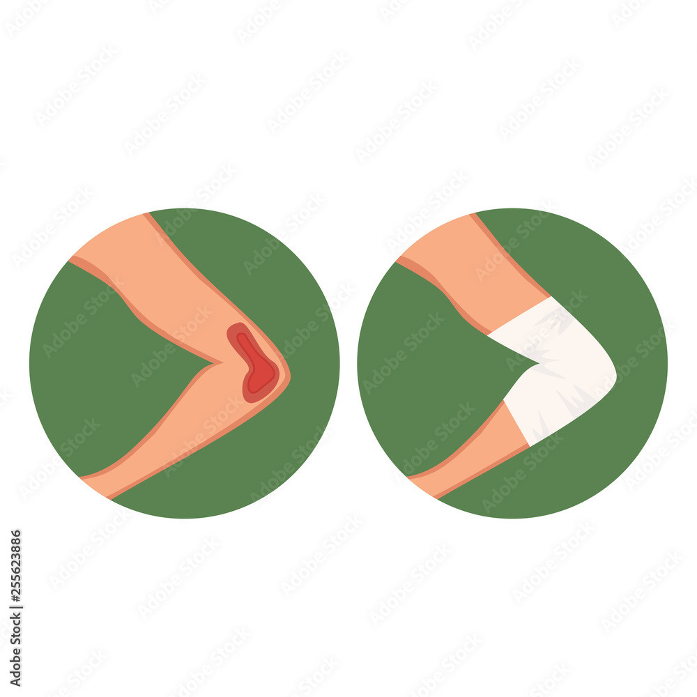 Open gap, injured elbow and medical dressing