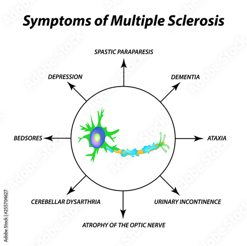Symptoms of multiple sclerosis. The destruction of the myelin sheath on the axon. Damaged myelin. World Multiple Sclerosis Day. Infographics. Vector illustration on isolated background.